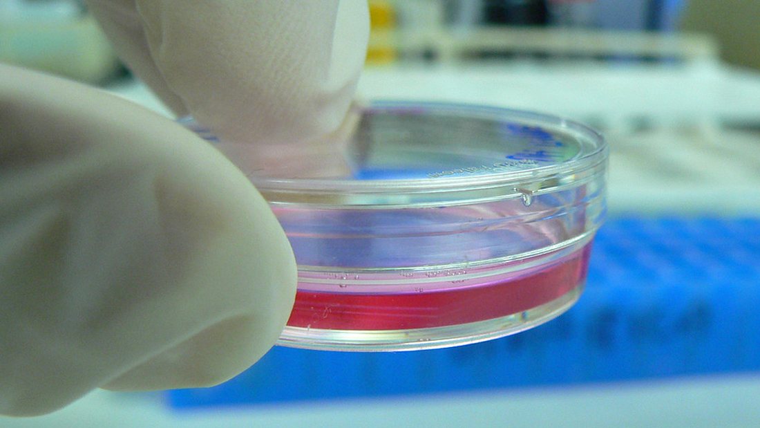 Laboratory testing of plant extracts